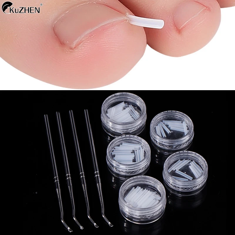 Gancho de cuidados com as unhas do dedo do pé encravado dupla extremidade correção levantador arquivo manicure pedicure unhas dos pés limpo ferramenta de cuidados com os pés