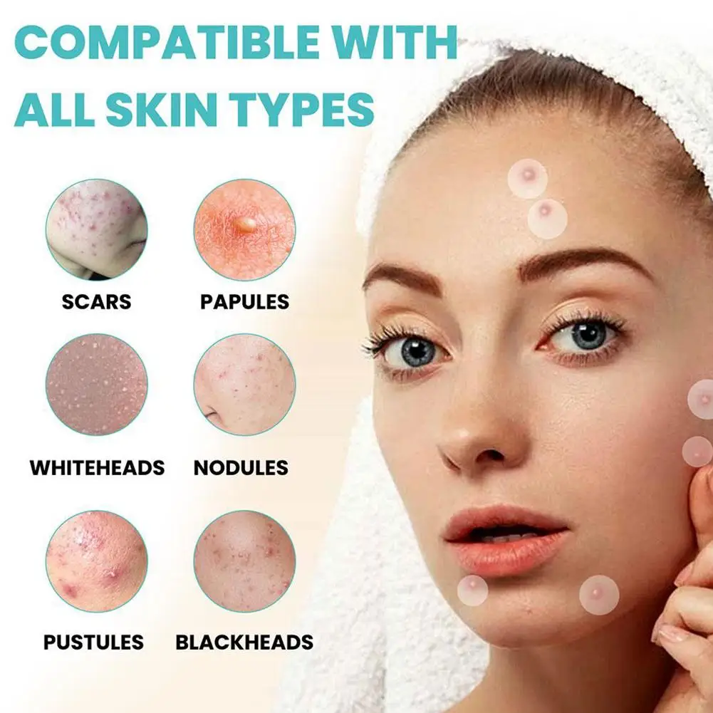 1/3/5 صندوق حب الشباب التصحيح الملونة ستار ماكياج المخفي لصق المياه الغروانية العناية بالبشرة الأرجواني حب الشباب بثرة التصحيح الجلد كشط الجمال