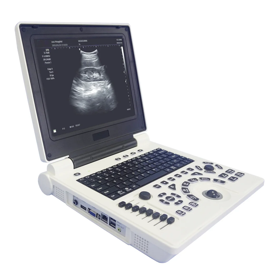 

CE Approved Laptop Full Digital Portable 12 inch LCD Display medical ultrasound scan machine