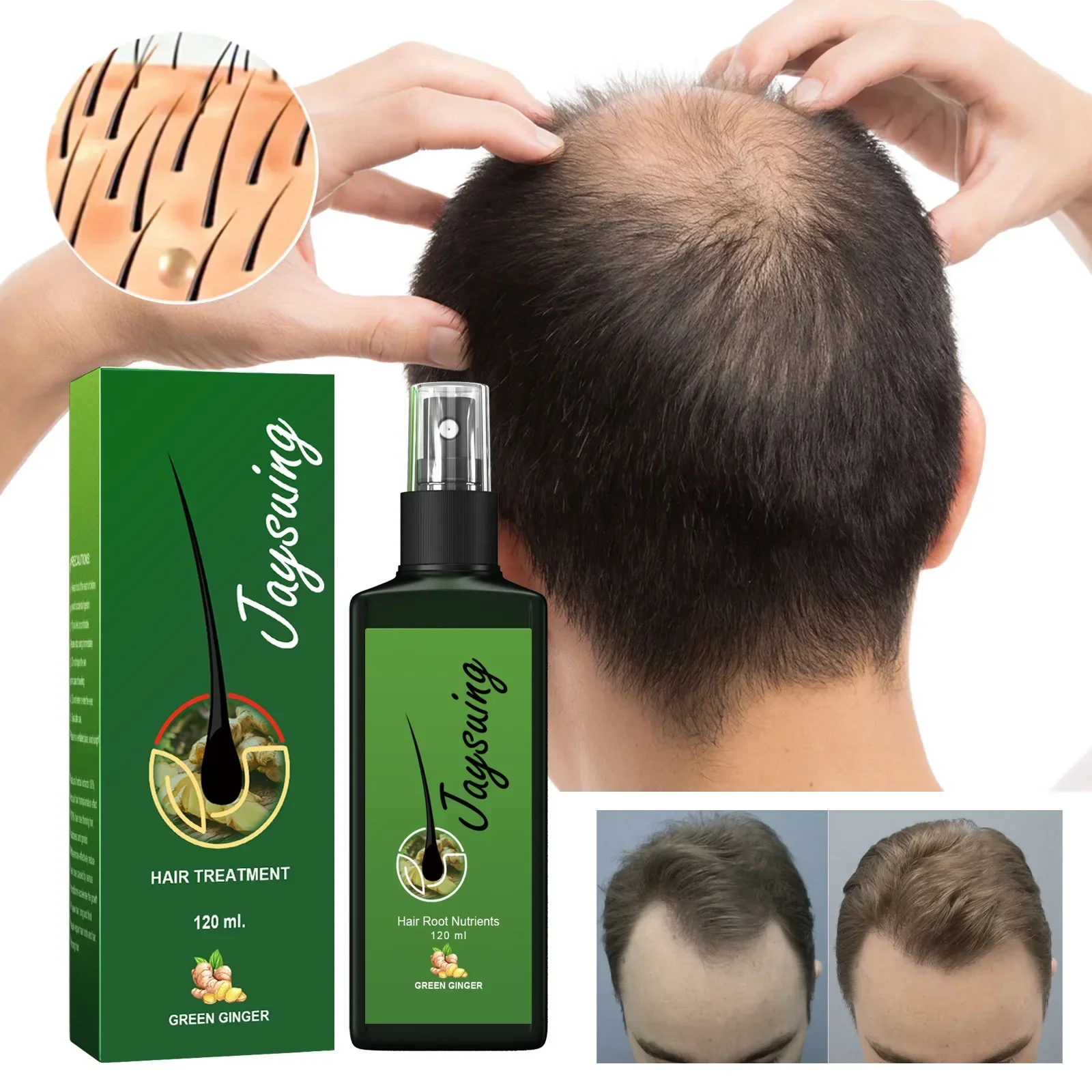 120ml Jaysuing Hair Growth Oil Strong hair Scalp Massage Liquid Fast Growing Germinal Anti-loss Treatment Serum Hair Lotion