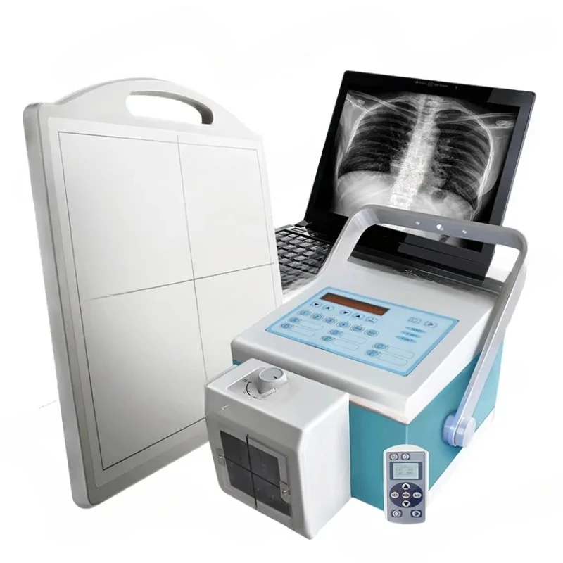 Medsinglong In Stock 10.4 Inch LCD Screen Mobile X High Frequency Portable X-Ray