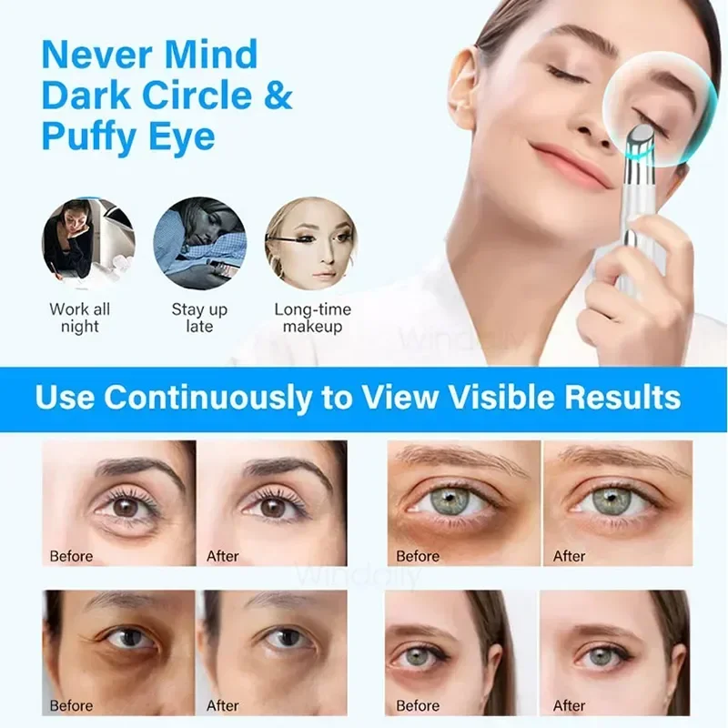 New Eye Beauty Device, Home Eye Care Device, Vibration Import Beauty Device, Gift Electric Hot Compress Eye Massage Device