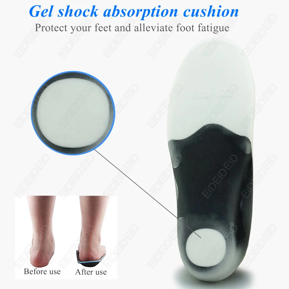 Picture 6: 3D Orthotic Insoles flat feet for kids Children and Adults Arch Support insole for X Legs Orthotic Shoe Heel Pad Inserts