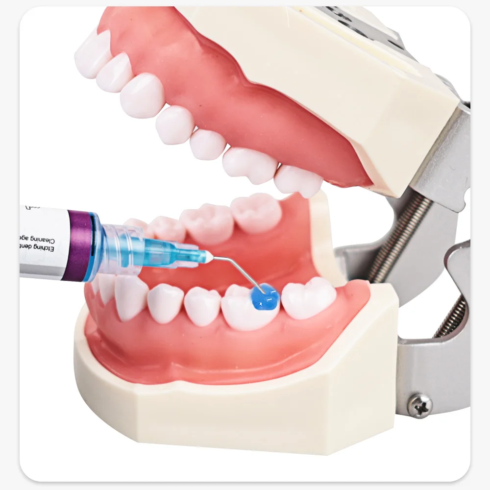 Dental Etchant Gel 37% fosforowy żel do trawienia kwasem dentystycznym Etchant Agent Dental ortodontyczny klej lekki utwardzający zęby Bond