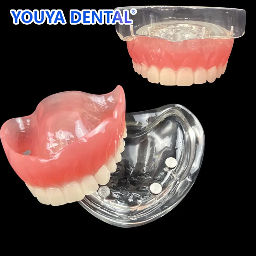 Dental Upper Overdenture Teeth Model Magnetic Adsorption Removable Superior Mandibular For Student Dentist Demo Study Teach