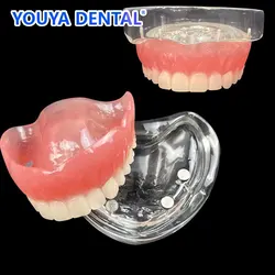 Dental Upper Overdenture Teeth Model Magnetic Adsorption Removable Superior Mandibular For Student Dentist Demo Study Teach