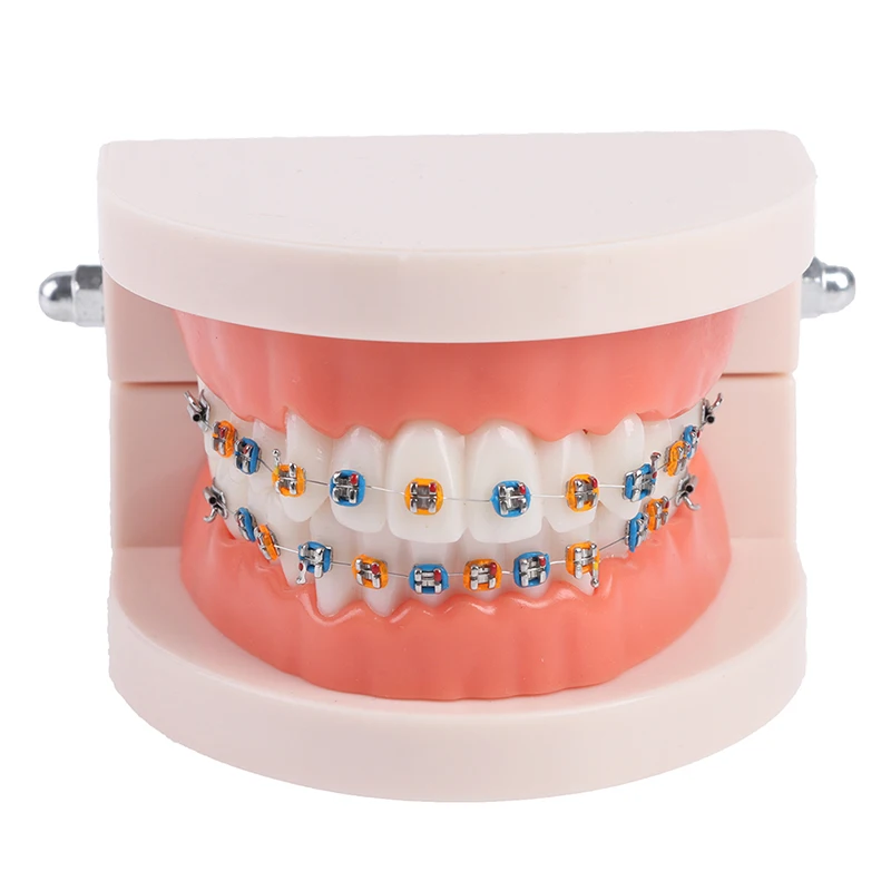 Dental Orthodontic Teeth Model With Metal Braces  School Teaching Equipment