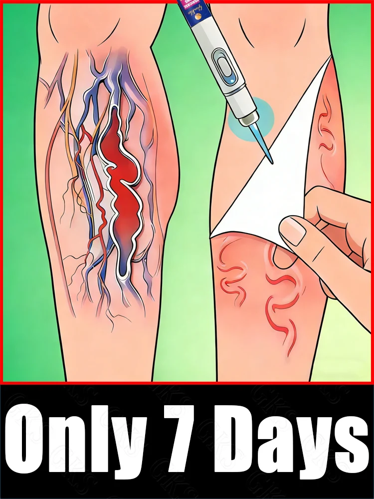 

Здоровые ноги и быстрое избавление от варикозного расширения вен.