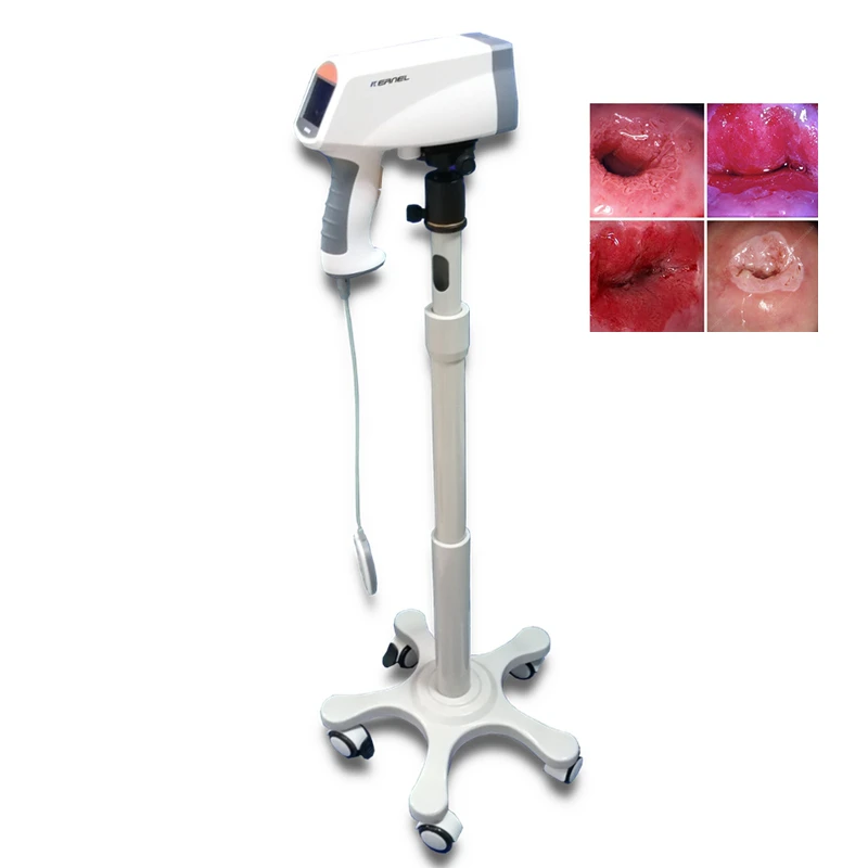 Portable Trolley Gynecology Vagina Examination Endoscope Kernel Full HD Digital Video Colposcope