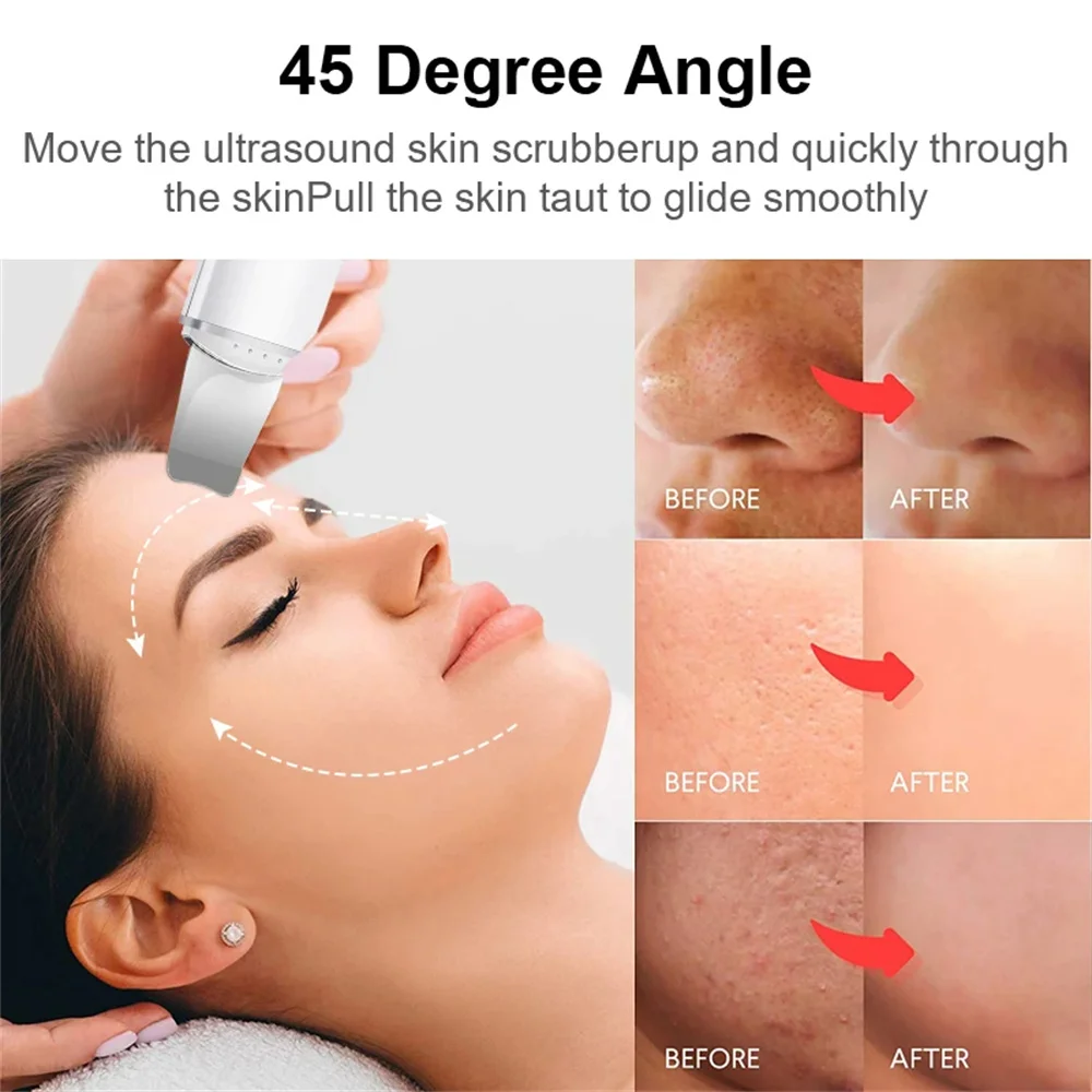 Ultraschall Haut wäscher Vibration Gesicht Spatel Mitesser Entferner Schaufel saubere Kavitation Peeling Gesichts lifting Hautpflege