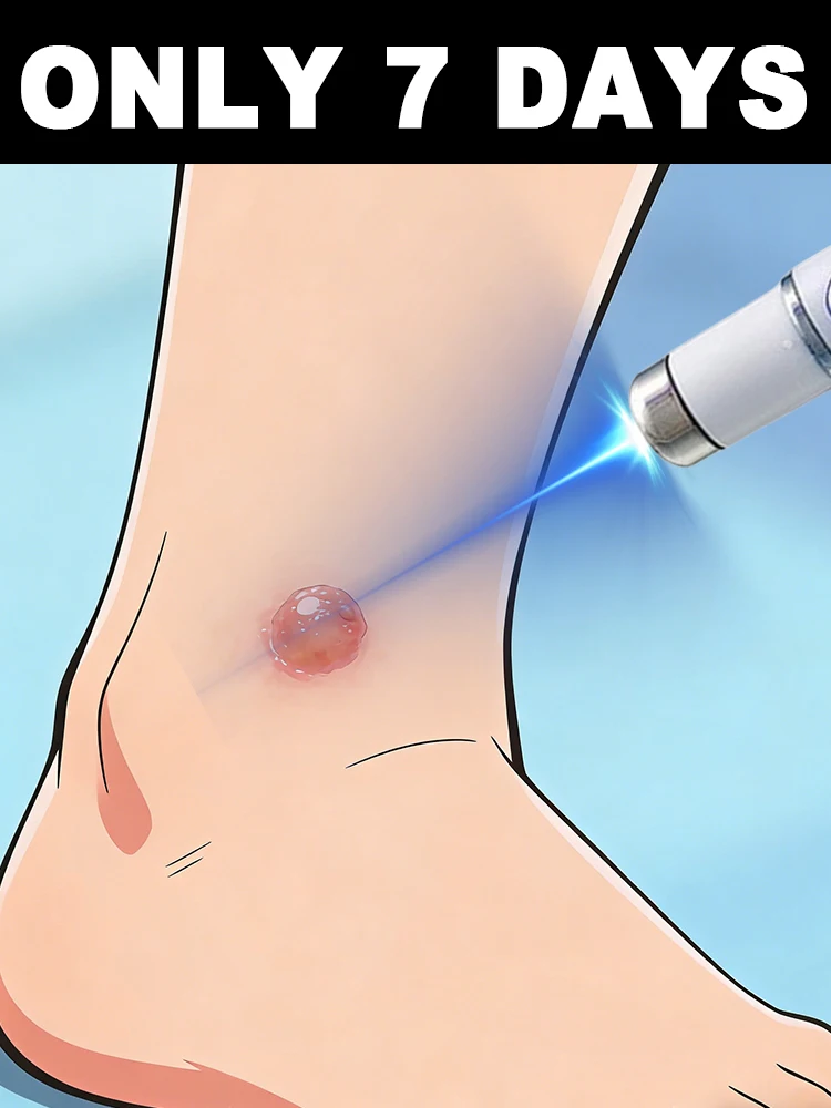 

Whether it's old or new warts, ᵃ ᵍᵉⁿᵗˡᵉ ᵗᵒᵘᶜʰ ʷⁱᵗʰ ᵗʰᵉ ˡᵃˢᵉʳ ᵖᵉⁿ ˡᵉᵃᵛᵉˢ ᵗʰᵉ ˢᵏⁱⁿ ᶜˡᵉ