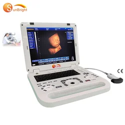 hot sale 15 inch black and white 3D Medical ultrasound machine portable USG scanner