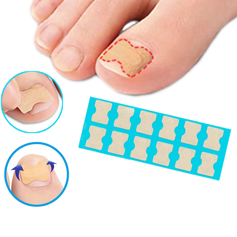 

Ingrown Nail Corrector Toe Nail Sticker Free Pedicure Tool Foot Care Professional Home Use Paronychia File Elastic