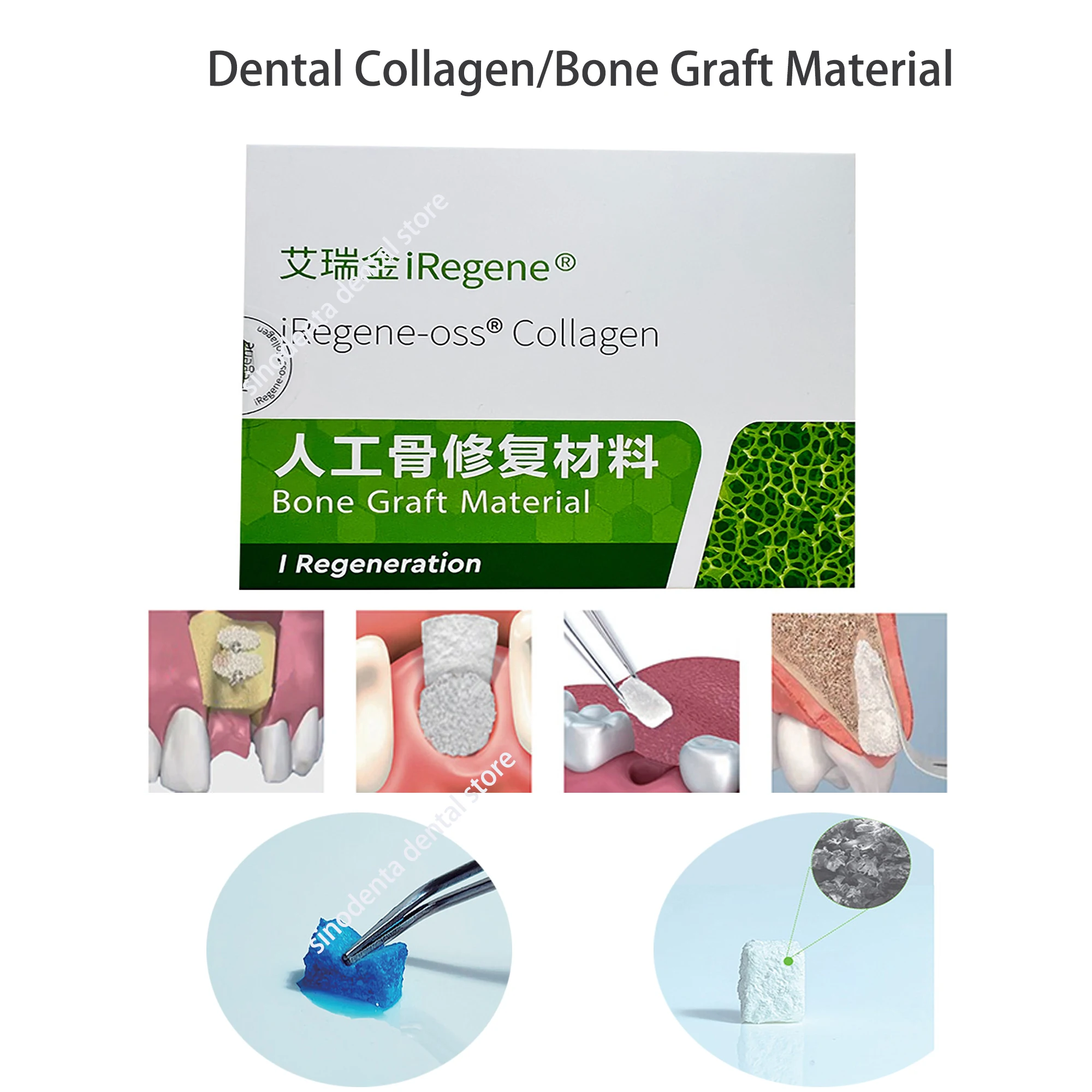 

Dental Implant Surgical Bone Graft Material Dental Collagen for Alveolar Ridge Preservation and Implant Surgery Cases Used