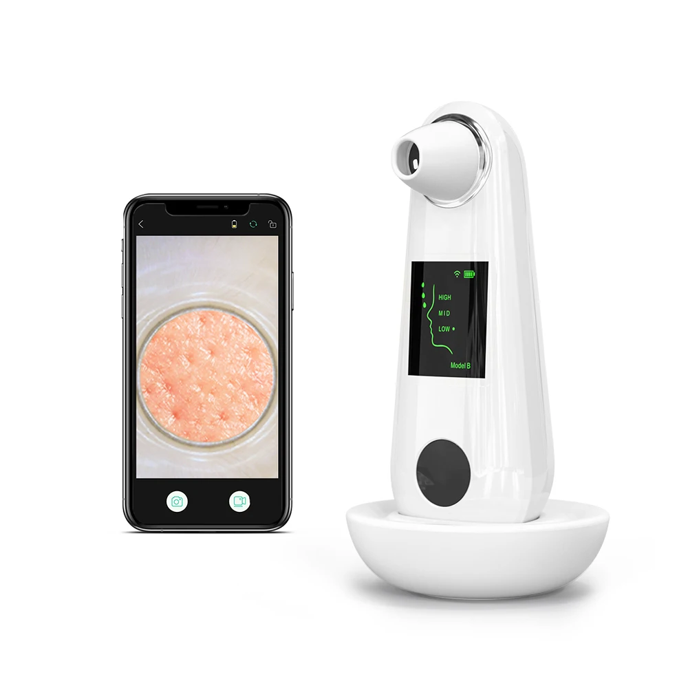 Smart Library Beauty Customized HD Vacuum Pore Cleanser Hot Cold Blackhead Remover Newest Factory Customized Visual