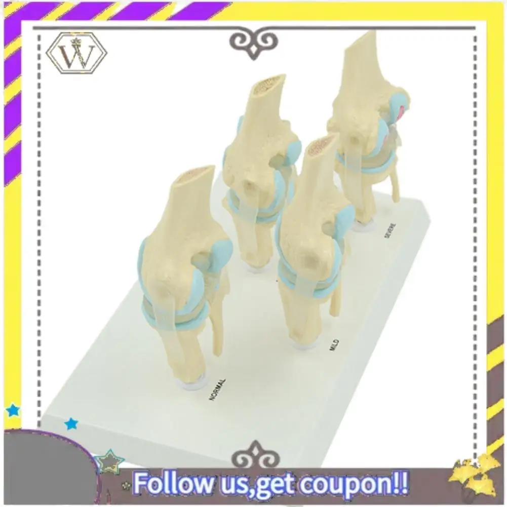 

New Anatomical Human Degenerative Knee Joint Model Skeleton Anatomy Teaching Resources