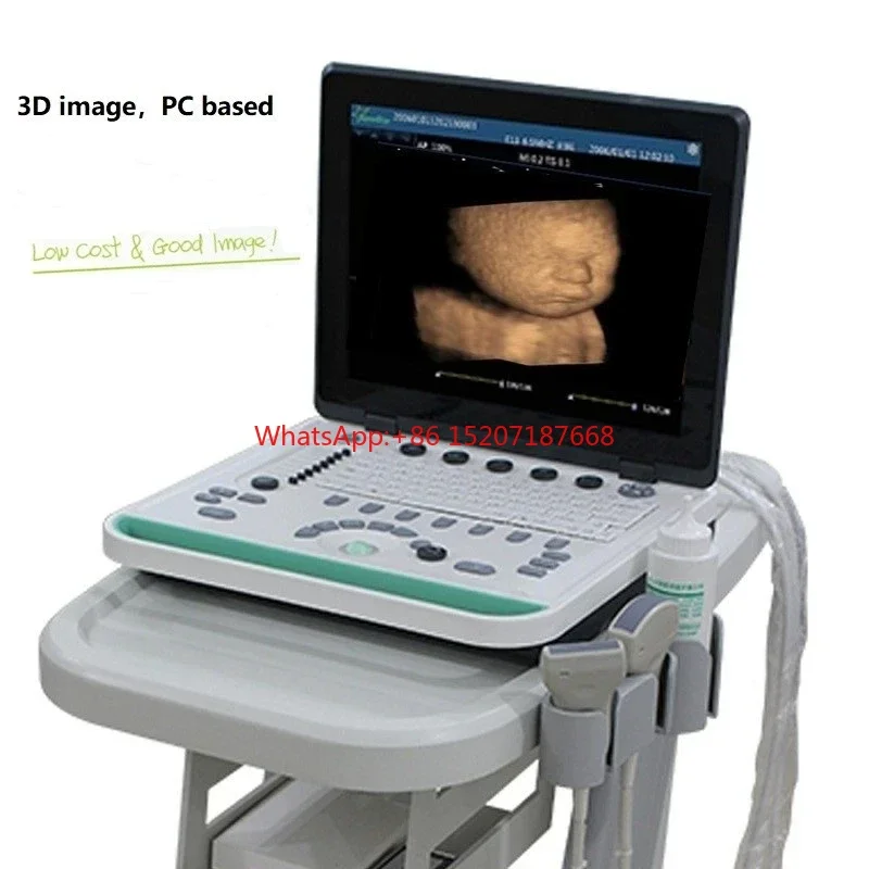 

Li-Battery PC 3D Based 15 Inch Notebook Black and White Ultrasound Scanner Machine