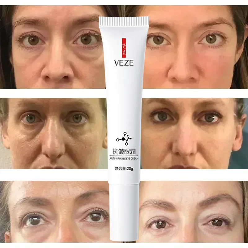 Ácido hialurônico soro hidratante contra o inchaço, Gel Eye Care, Remover círculos escuros e olhos creme, Nicotinamida Eye Bags