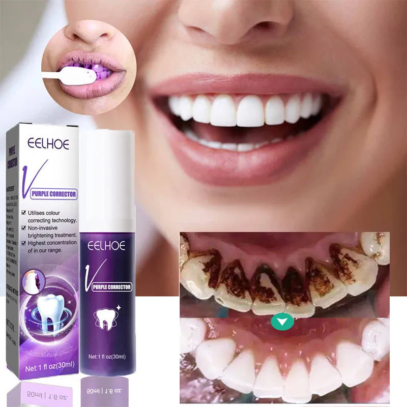 Whitening Tooth Toothpaste Freshen Breath Remove Smoke Stains Oral Hygiene Clean Effectively Removal Yellow Teeth Dental Care