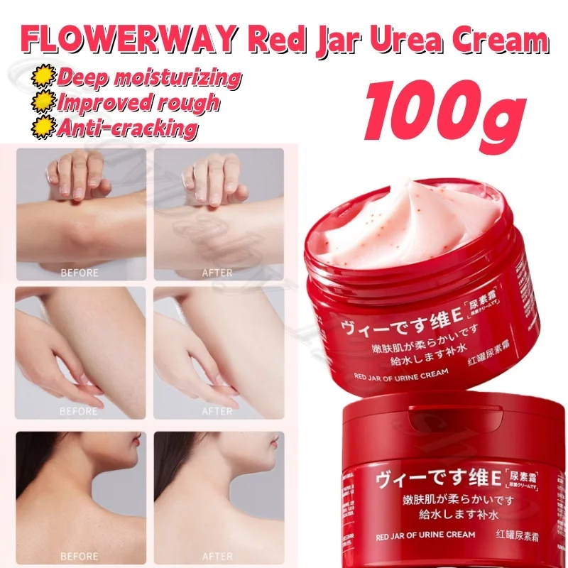 

FLOWERWAY Red Jar Urea Cream Hydrating Moisturizing and Moisturizing Dry Skin Anti-chapped Skin Body Cream 100g