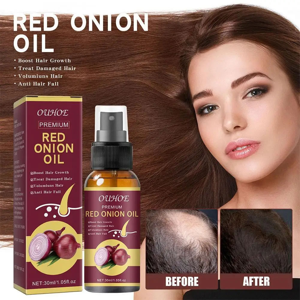 

OUHOE Red Onion Essential Oil Spray Extract Strong Firm And Moisturized Hair For Hair Care And Growth Prevent Hair Loss