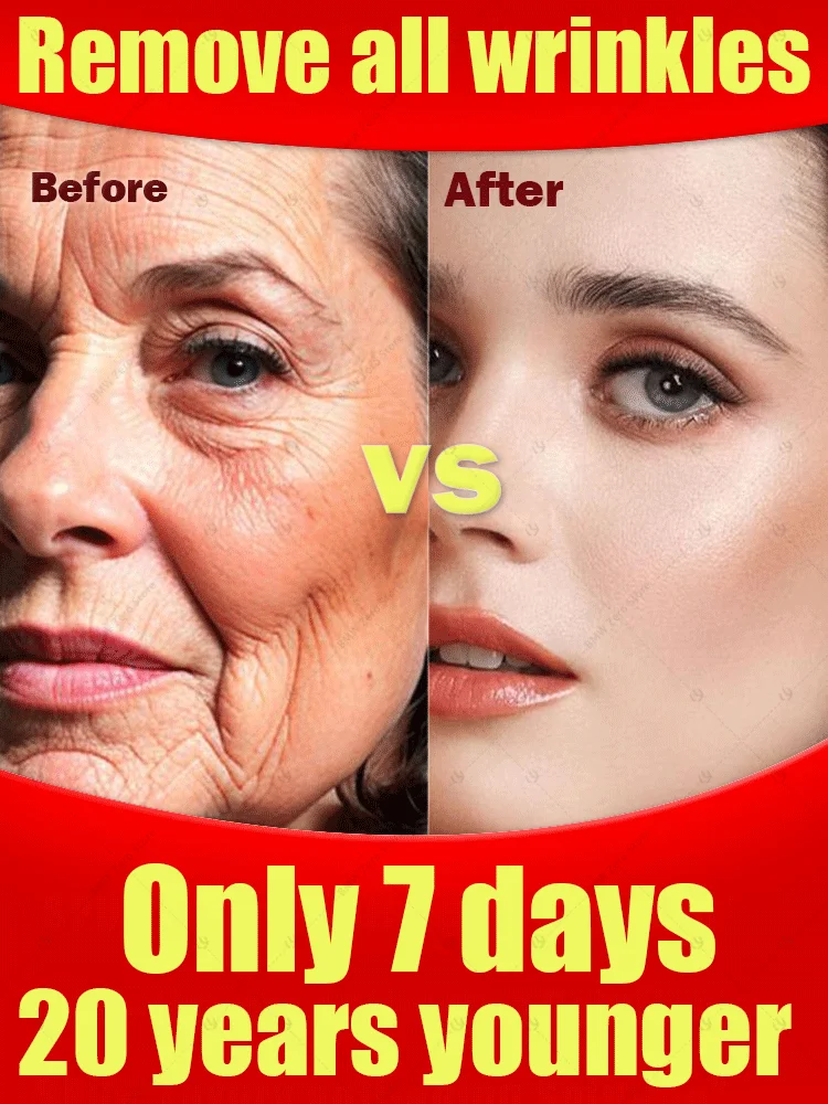 

Wrinkles disappear Become beautiful now