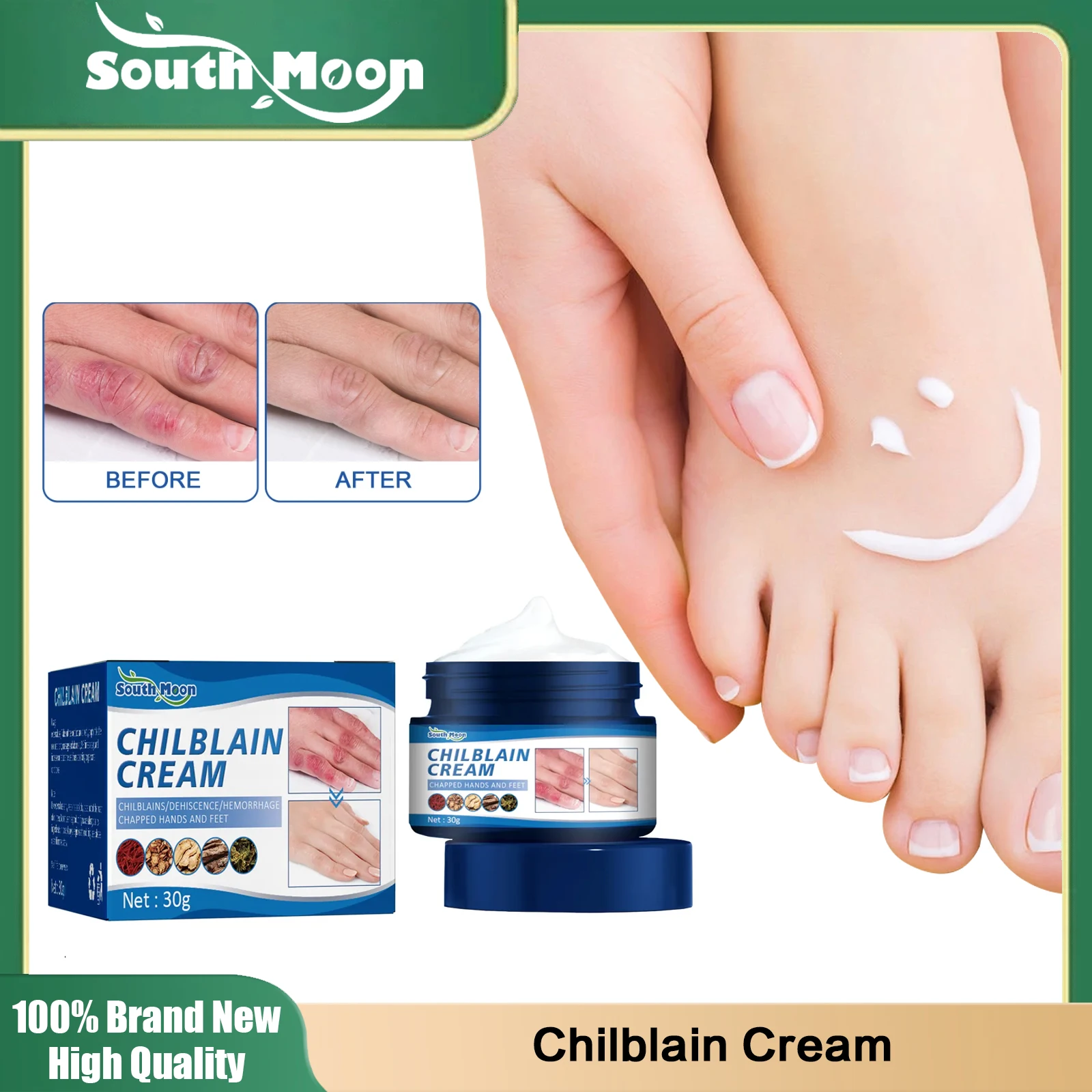 

South Moon Anti Chapping Foot Cream Treatment Chilblain Repair Hand Foot Dry Crack Frostbite Exfoliating Nourishing Feet Nursing