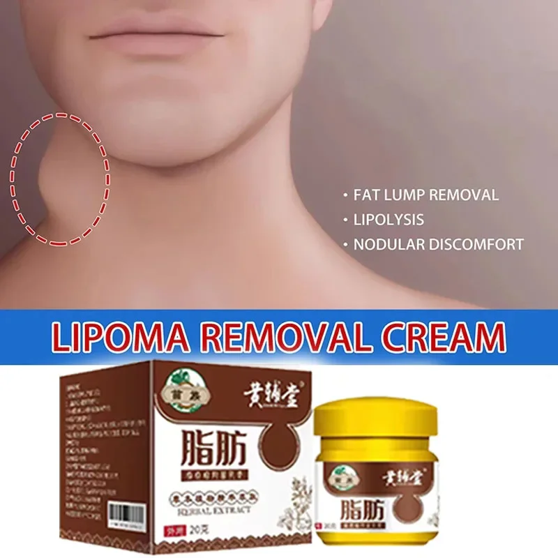 Lipoma krim penghilang menenangkan, krim penghilang selulit benjolan Fibroma disinfeksi, penghilang lemak aman untuk nyeri