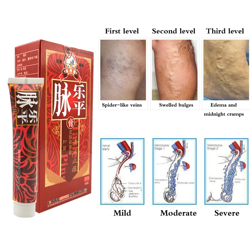 

30G Maileshu Varicose Vein Cream For The Treatment Of Varicose Veins Spider Type Leg Varicose Vasculitis Health Plaster Ointment