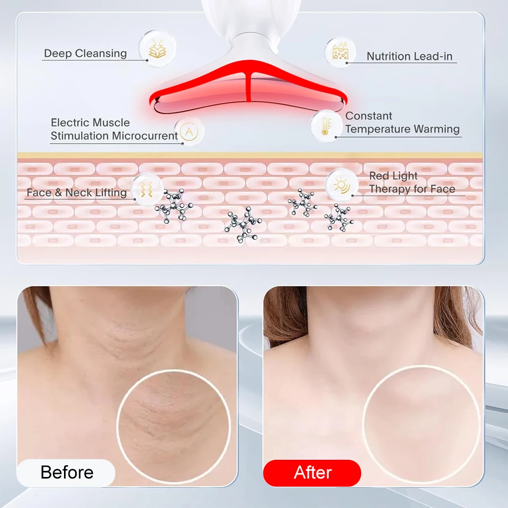 ใช้ในบ้านความงามกระชับผิวอุปกรณ์ต่อต้านริ้วรอยใบหน้าคอริ้วรอย Micro Current Lifting Massager