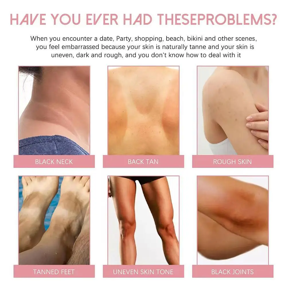 Underarm And Groin Whitening Cream Bleaching Whiten Butt Knee Brighten Inner Thigh Intimate Parts Dark Remove Care