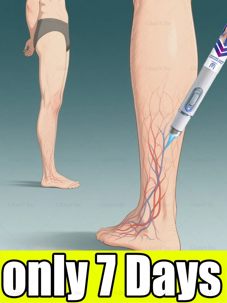 

7-Day Miracle: Gen-2 Photon Tech Tackles Varicose Veins