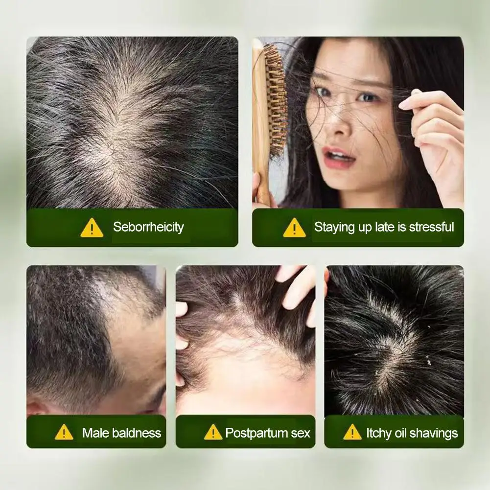 

Orchidaceae Usman Grass Shampoo Handmade Solid Soap Hair Nourishing Hair Oil Control Refreshing Fluffy Soothing Hair Follicles