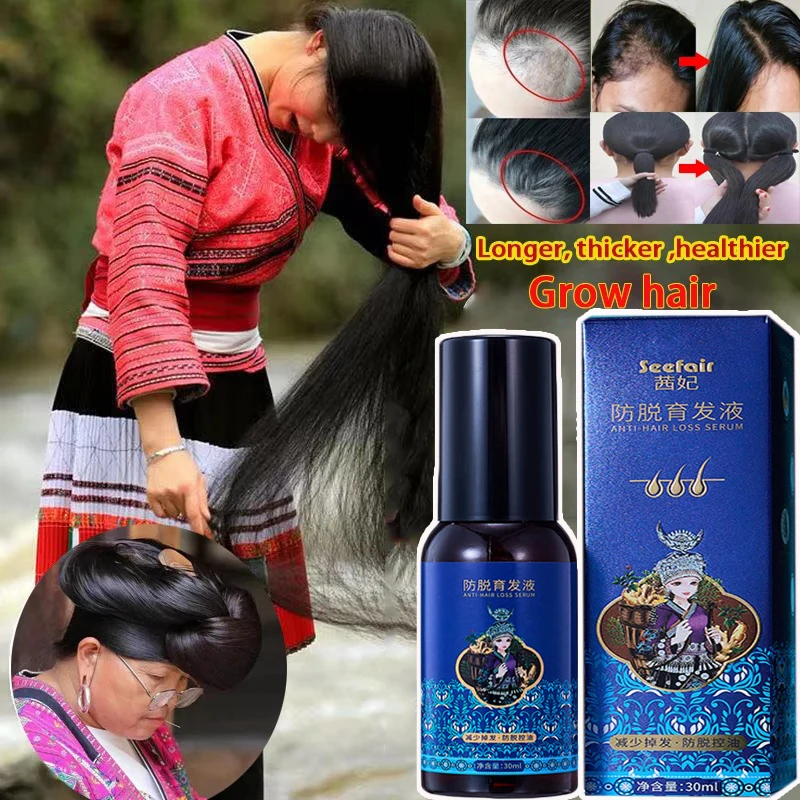 

Natural Herbal Hair Growth Spray Anti Loss Scalp Damaged Repair Hair Regrowth Serum Liquid Thicken Hair Health Care Men Women