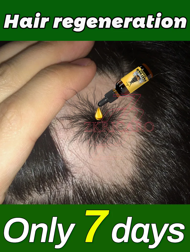 Upgraded haír root care 0íl, thick haír, thíck haír roots, effectíve in 7 days, Save Your Haír