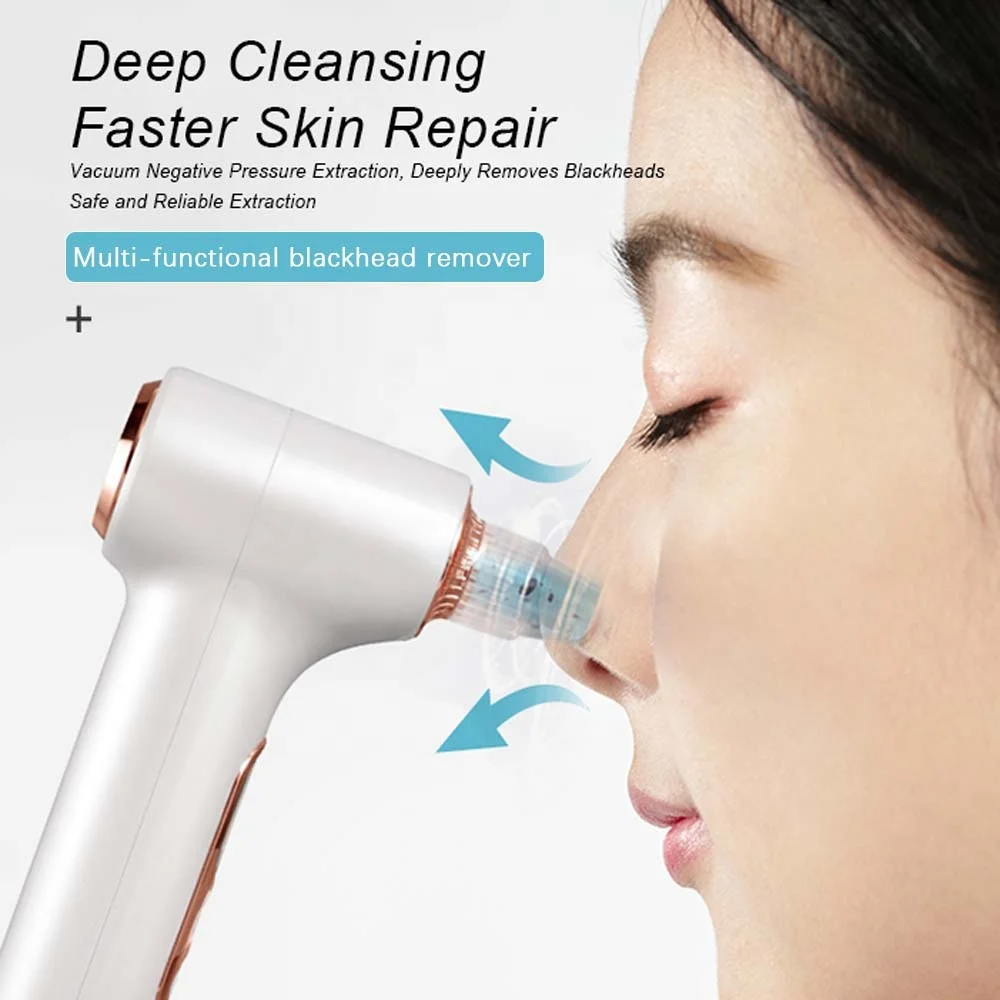 Strumento di bellezza elettrico Aspirazione di ossigeno Impacco caldo Pulizia profonda Detergente per viso nero Aspirapolvere per rimozione punti neri Detergente per pori