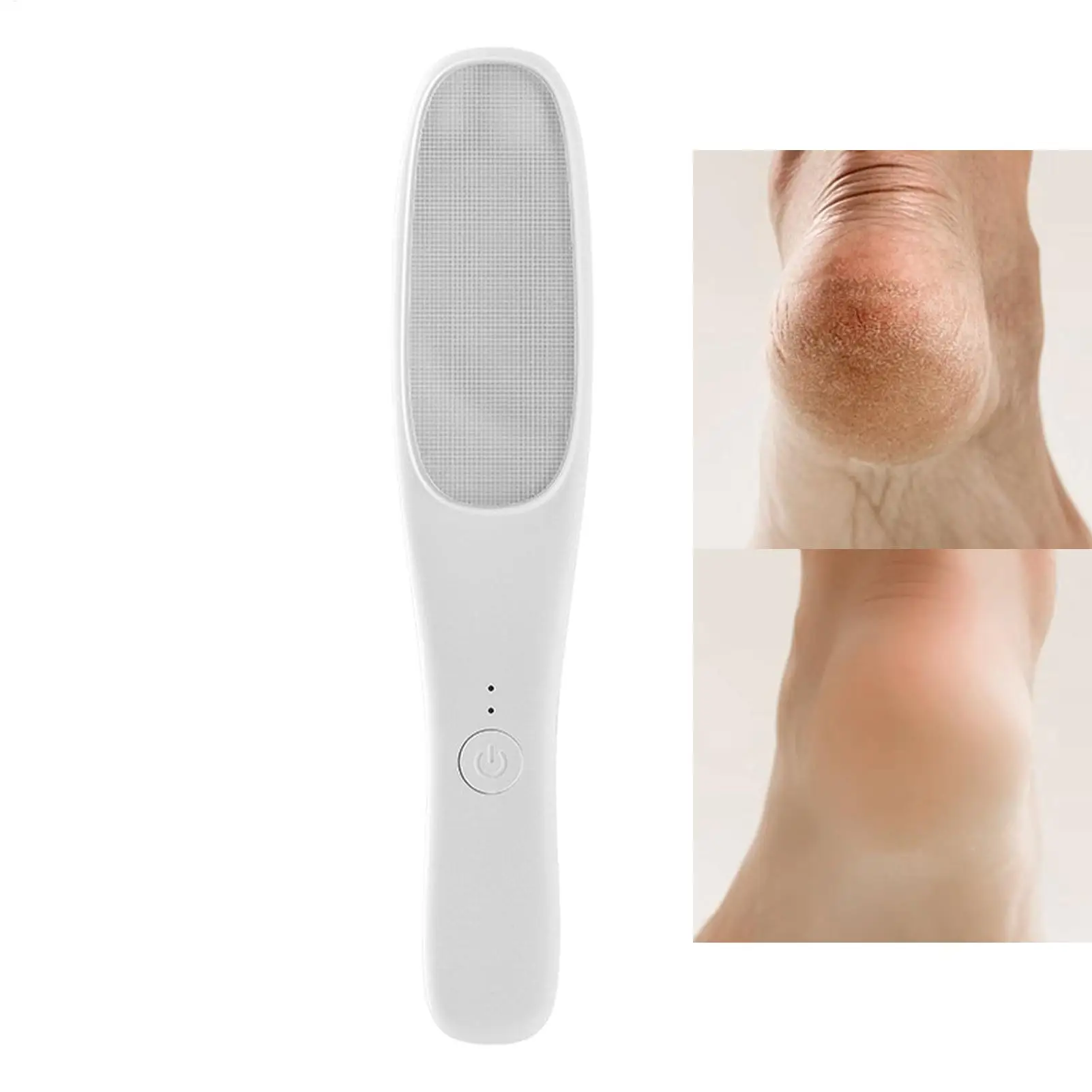 Electric Foot Callus Remover Feet Callus Remove Rechargeable Dead Wet Dry Skin Calluses Foot Cleaner Smooth Electric Foot File