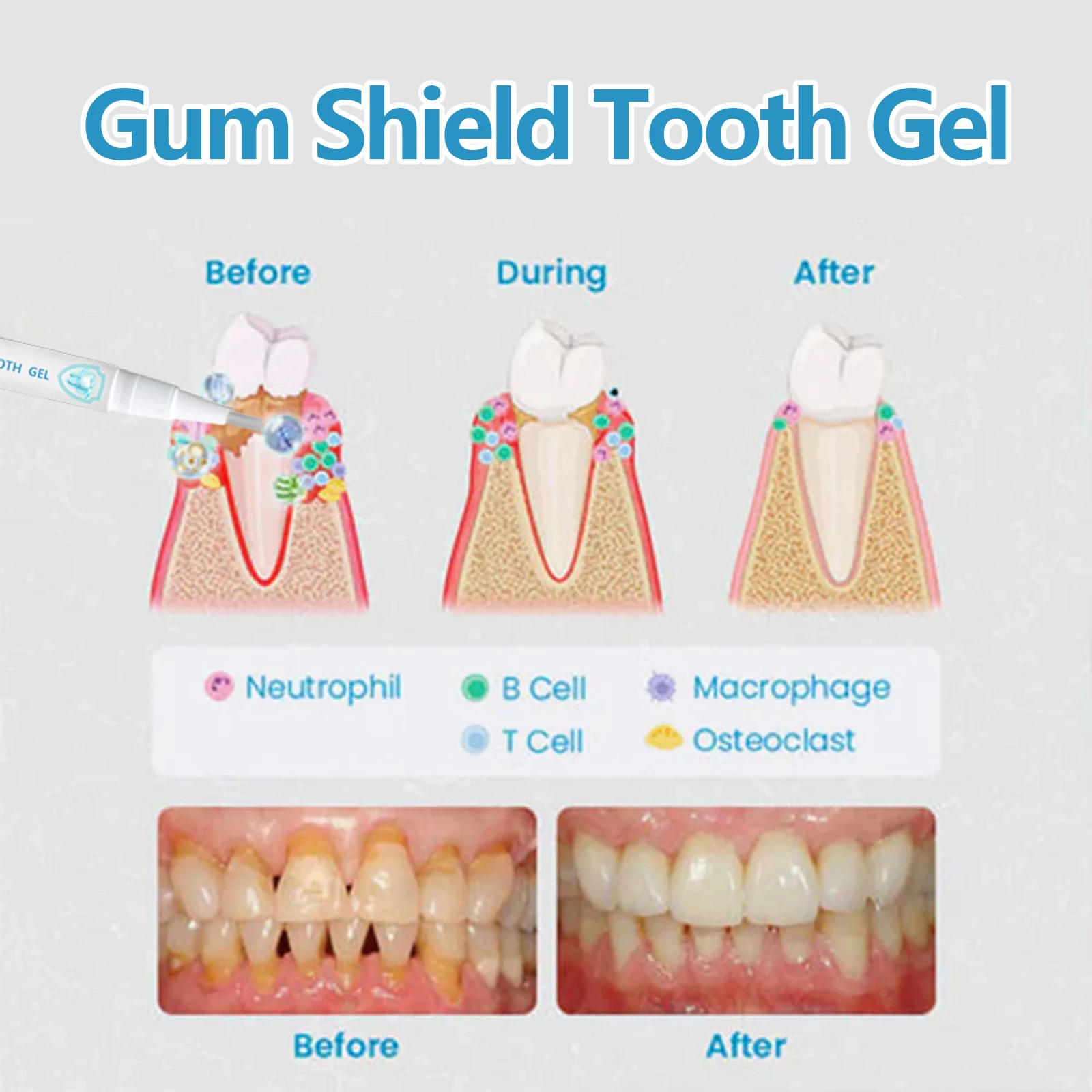 Gum Recession Treatment Gel Ef - Teeth Whitening Effective recension och pris