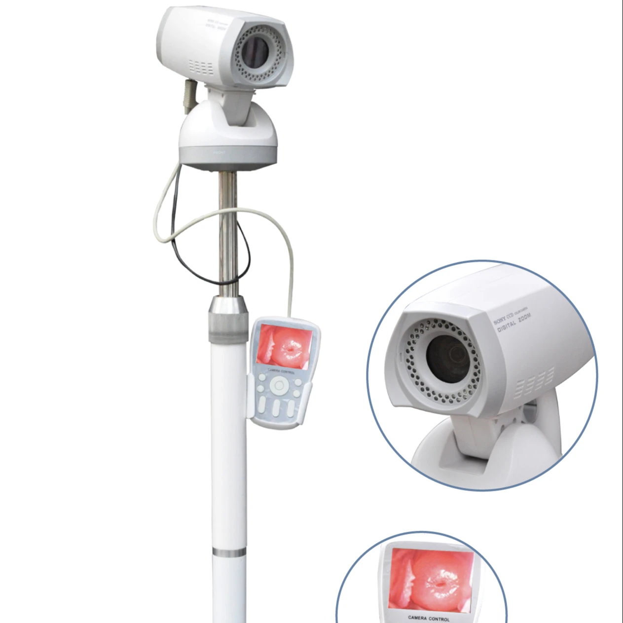 

Video With Tripod Gynecological Clinical Diagnostic Instruments