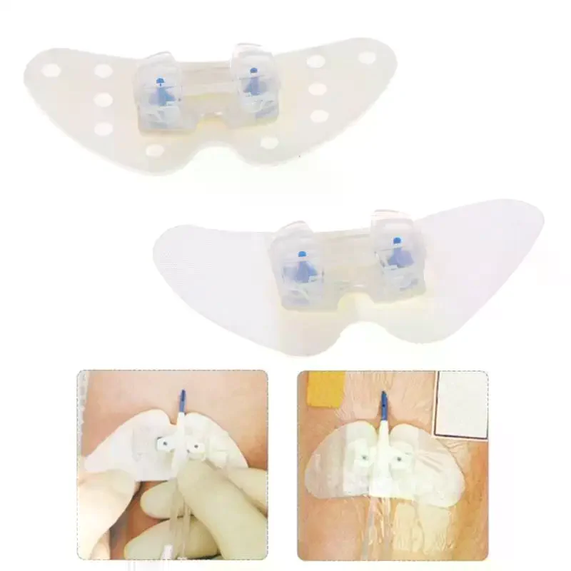 Catheter Fixation Universal Fixing Sticker Tape Leg Retainer Holder Drainage Tube Device 1PCS