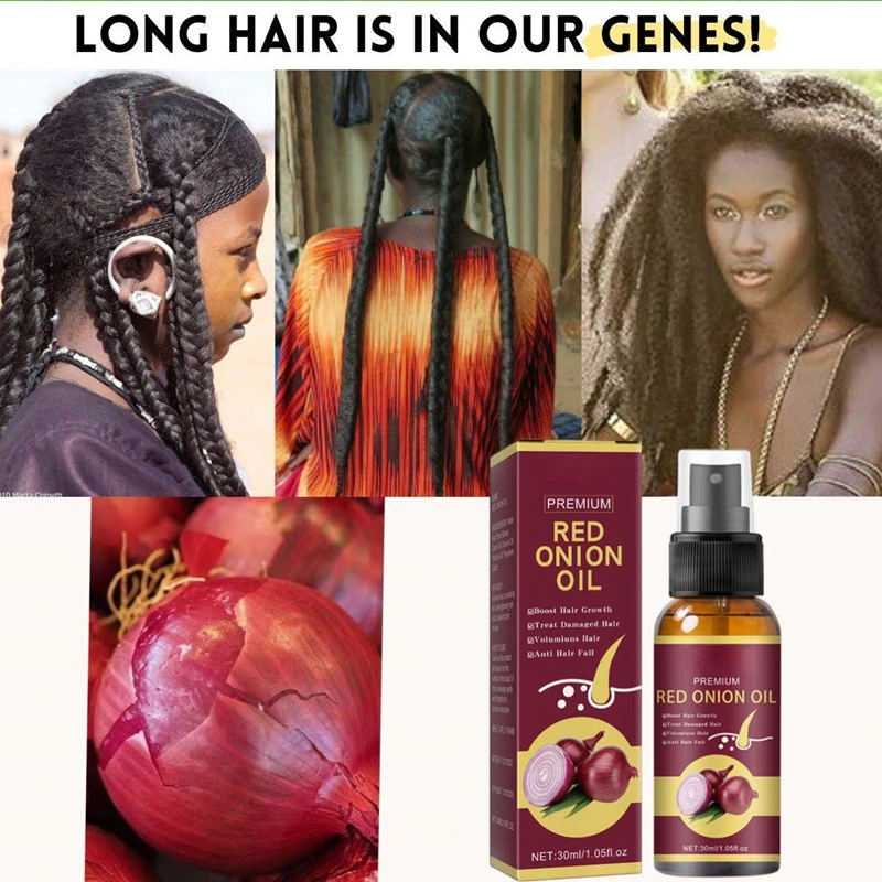 

30ml Onion Black Seed Hair Oil Spray Natural Hair Care And Growth Prevent Hair Loss Biotin Fast Hair Growth Scalp Treatment