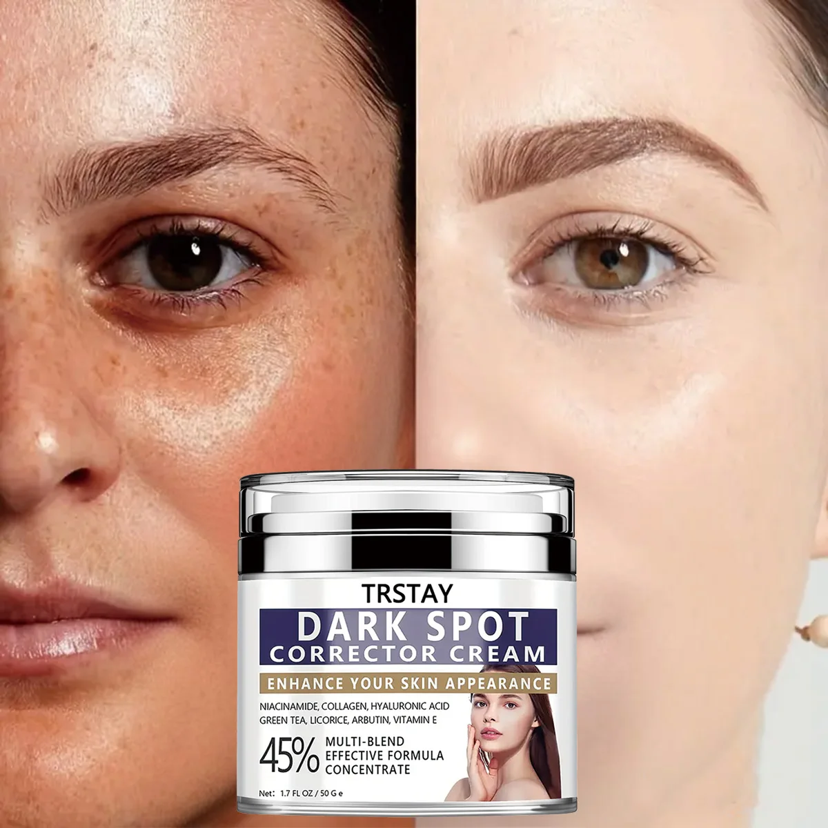 TRSTAY Dark Spot Correction Cream Niacin Facial Skin Care Enhances Appearance Pregnancy & Maternity Mother & Kids