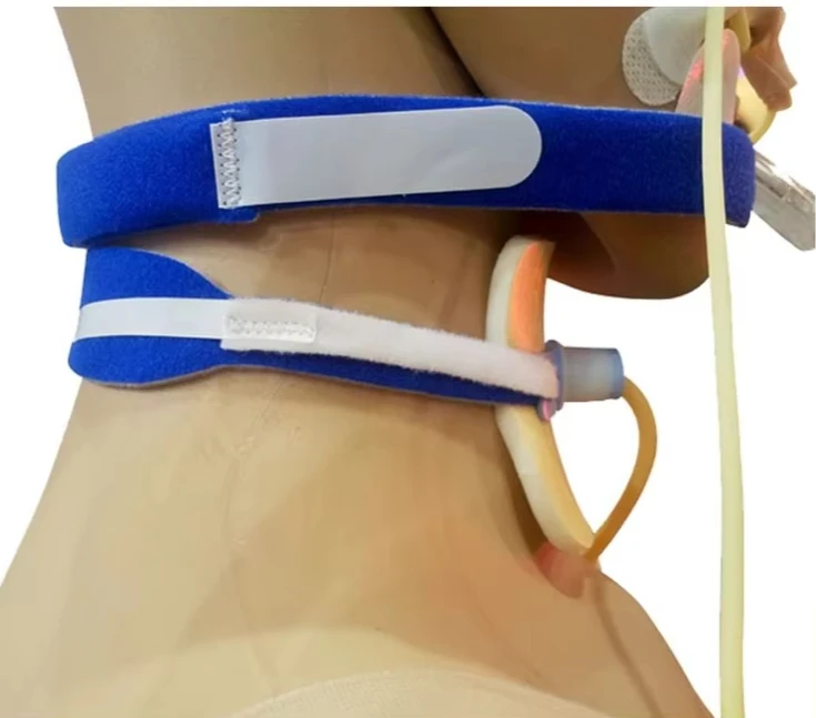 

Medical Endotracheal Tube Holder Catheter Support Brace Tracheostomy Fixed Device Fixed Belt