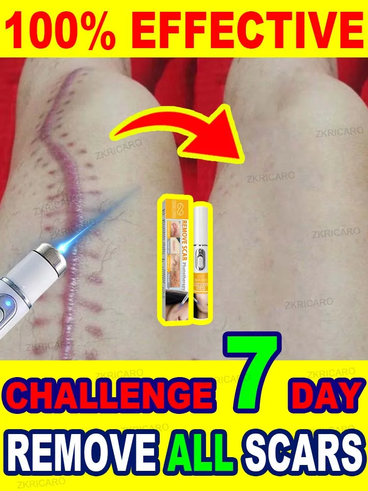 No scars, smooth skin