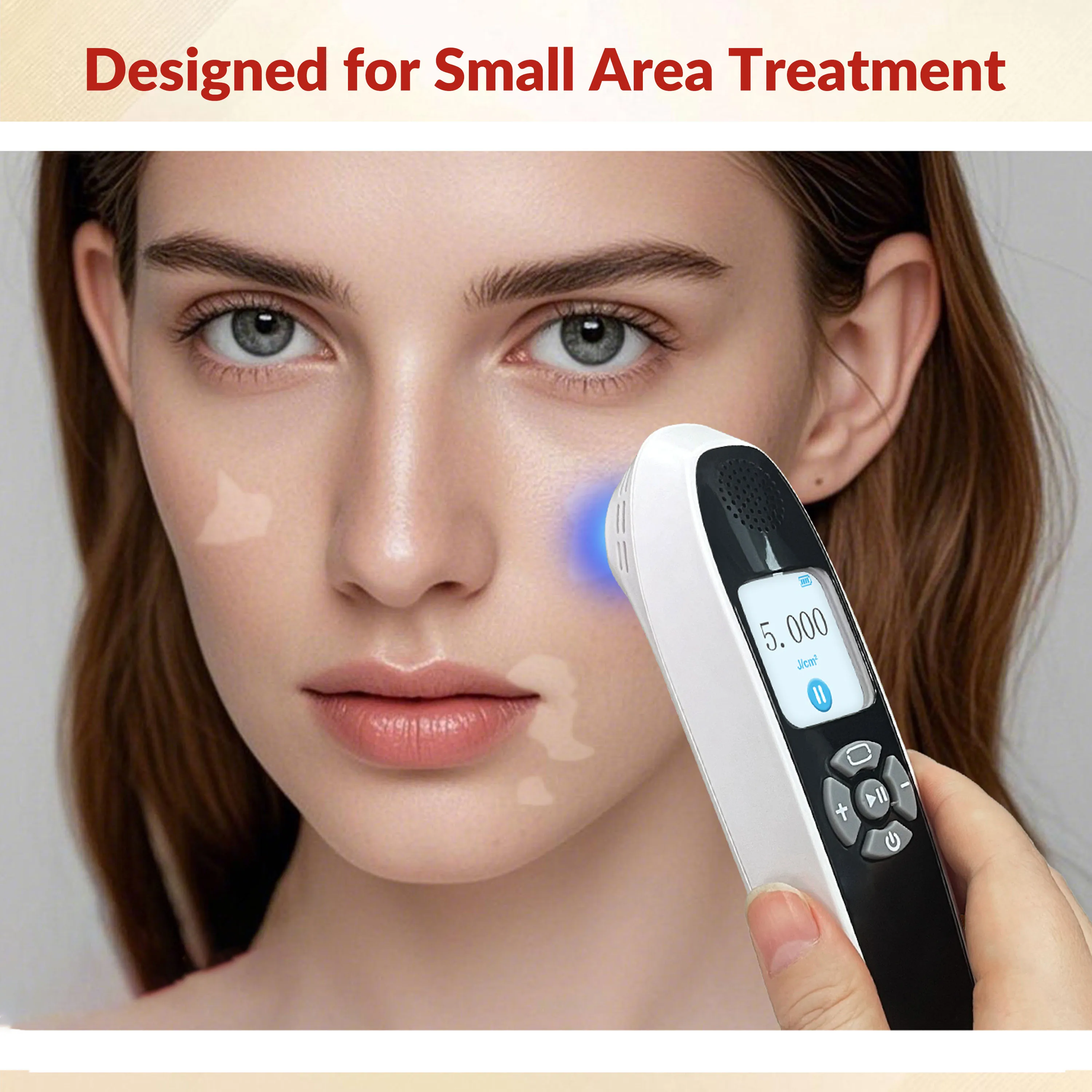 

ZJZK Home Ultraviolet Light Therapy for Skin Conditions Vitiligo Psoriasis Narrowband UVB Phototherapy Lamp 308nm 6pcs 9pcs
