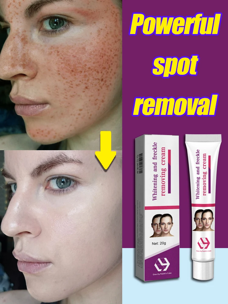 Dark Spot Cream For Face