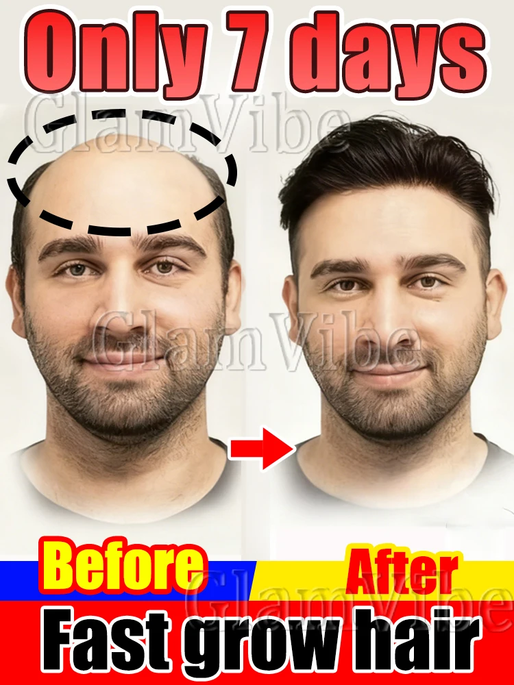 

Sповысить над вашим головой, azi, как строители.