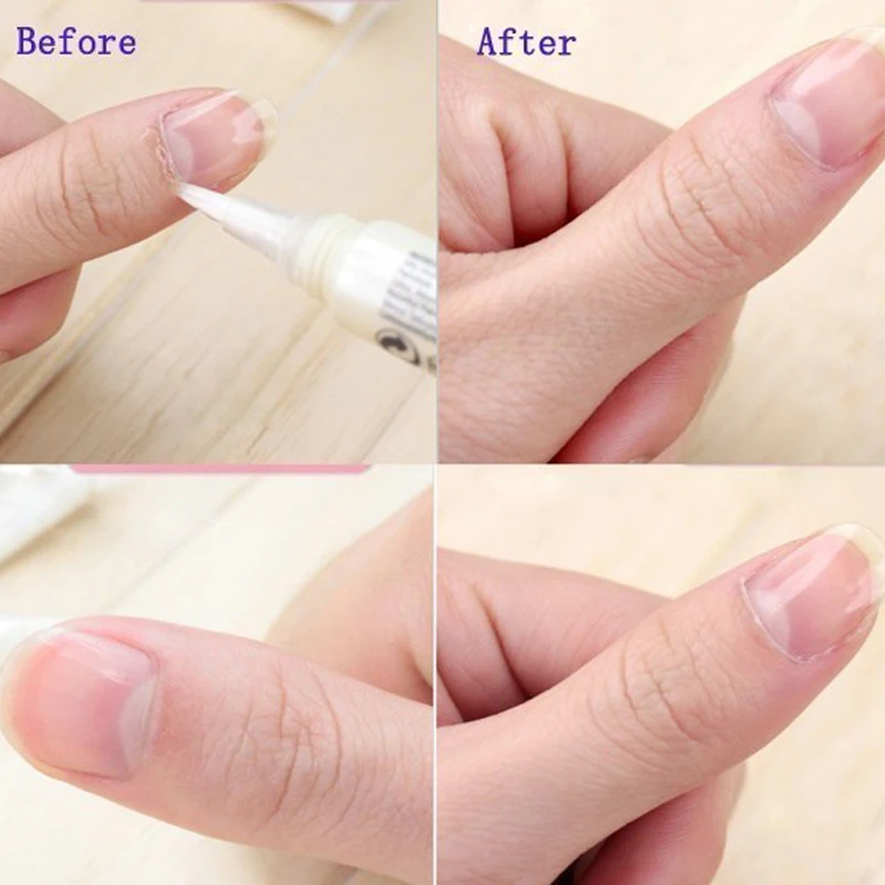 30/15PCS Cuticole Olio Penna Nail Revitalizer Nutrizione Olio 15 Odori Trattamento Unghie Morbido Nutriente Manicure Nail Care Product Set