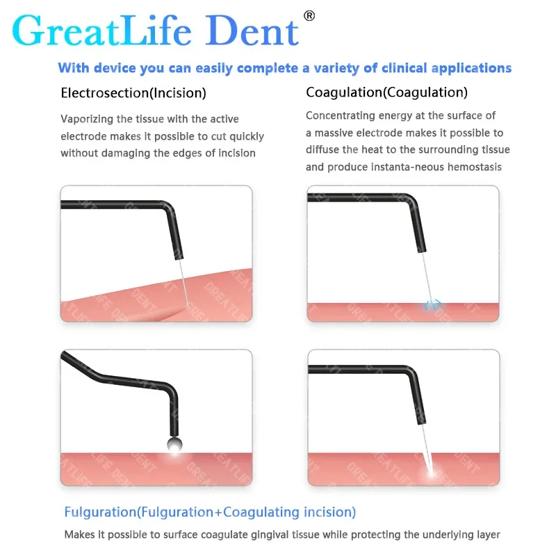 GreatLife Dent ทันตกรรม Electrosurgical หน่วย 40W ความถี่ Electro Surgery Scalpel ศัลยกรรมช่องปากไฟฟ้ามีดทันตกรรมเครื่อง