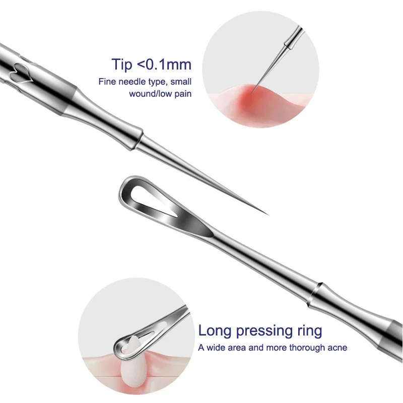 Rimozione di punti neri Brufolo Popper Strumento Acne Ago Rimozione Trattamento Punti bianchi Popping Zit Naso Viso Estrattore di imperfezioni Detergente
